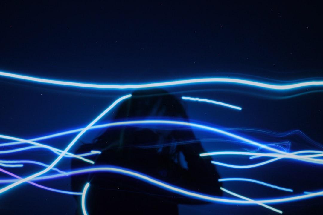 Đau nửa đầu (Migraine) không chỉ là một cơn đau đầu thông thường